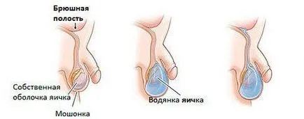 Операции в дома