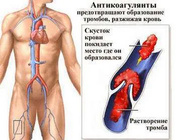 Как да пререждам кръвта на народни средства