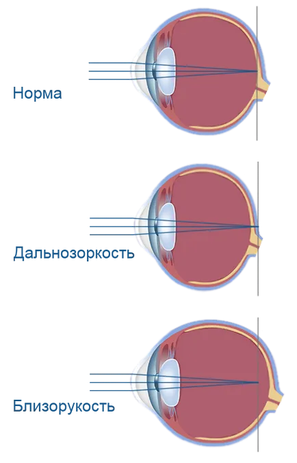 Нарушаването на името