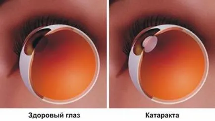 Нарушаването на името