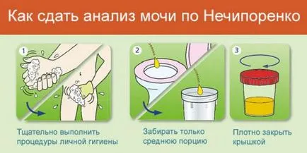 Как да се увеличи на белите кръвни клетки в урината