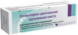 Езикът й, отколкото лечение Езикът й, отколкото лечение