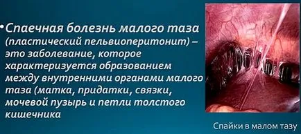Сраствания как да го лекуват