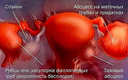 Сраствания как да го лекуват