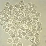 Какво е дневното производство на урина