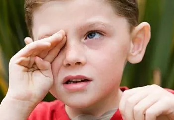 Chalazion лечение на дете