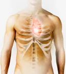 A cardiovascularis betegségek