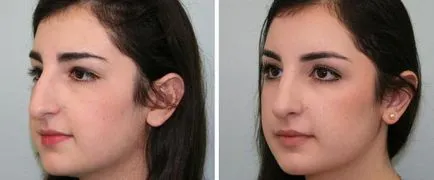 Hogyan készítsünk egy kis orr Hogyan készítsünk egy kis orr