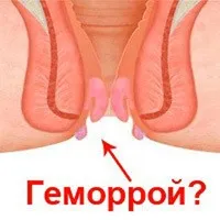 Сърбеж лечение ануса