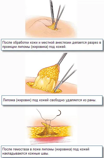 Каква е под кожата