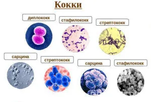 Болка в пикочния мехур, което е Болка в пикочния мехур, което е