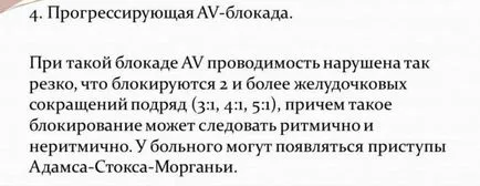 Какво е непълен сърдечен блок