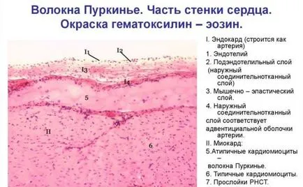 Какво е непълен сърдечен блок