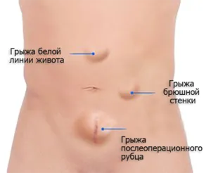 А херния, че това третиране