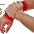 лечение Hygroma четка