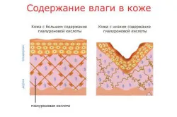 Хиалуроновата киселина е това, което се съдържа