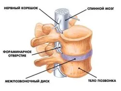 Какво е дискова херния