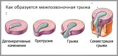 А херния, че това третиране А херния, че това третиране
