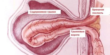 А херния, че това третиране А херния, че това третиране