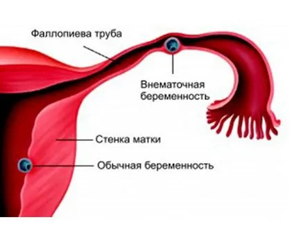 Как да се определи на бременност