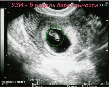 Как да се определи на бременност