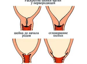 Как да се ускори на дилатация