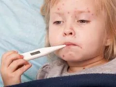 Варицелата е как изглежда
