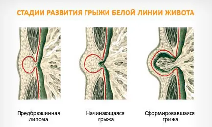 А херния, че това третиране