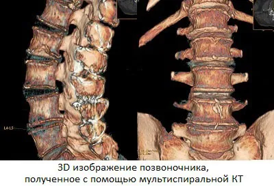 проучване томография