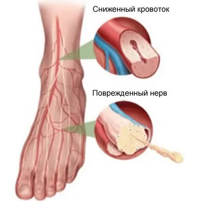 В подножието на гъши го