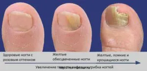 Като водопада на нокти