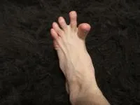 Szűk toe miért Szűk toe miért