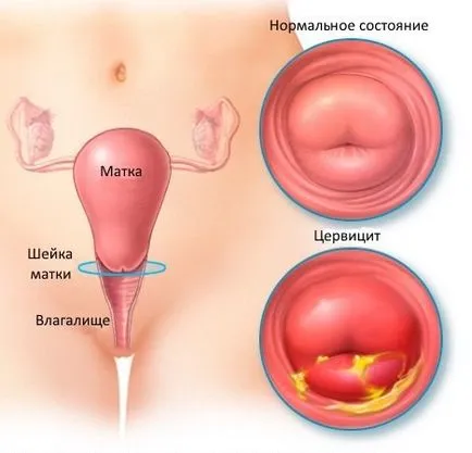Methyluracyl gyertyák Nőgyógyászati Methyluracyl gyertyák Nőgyógyászati
