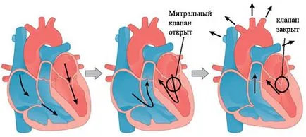 Какво е пролапси