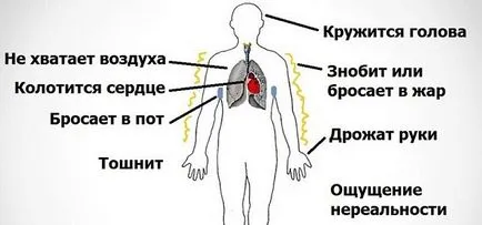 Какво е пролапси