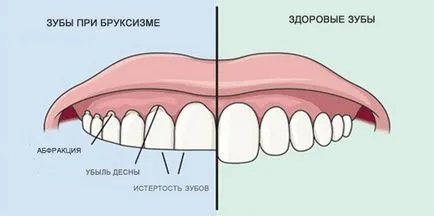 Какво мечта песъчинки за зъби