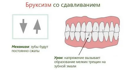Какво мечта песъчинки за зъби