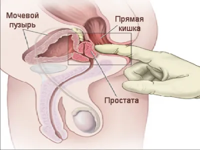 Как да се стимулира