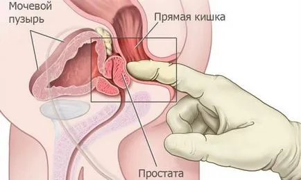 Как да се стимулира