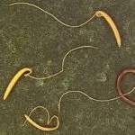 Trichocephalosis meg