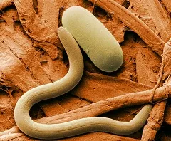 Trichocephalosis meg