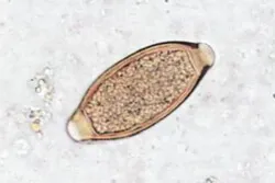 Trichocephalosis meg