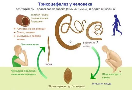 Trichocephalosis meg