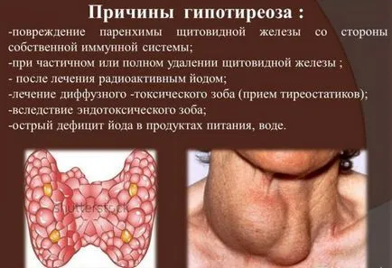 Ако щитовидната жлеза е намалена