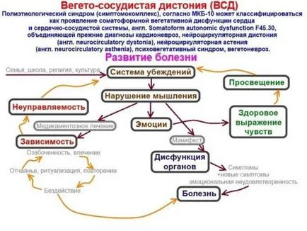 VSD на смесен тип, който е