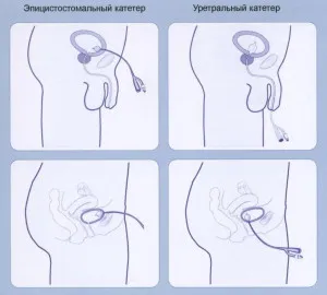 Как да отида до тоалетната на малкия