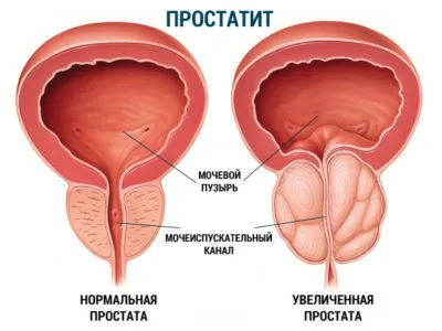 Как да отида до тоалетната на малкия
