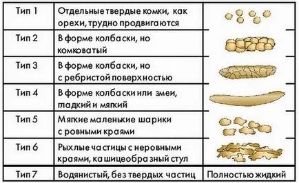 Какво да правите, ако запек