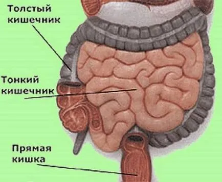 Какво да правите, ако запек