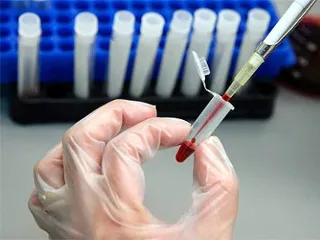 Какво е IgG анализ